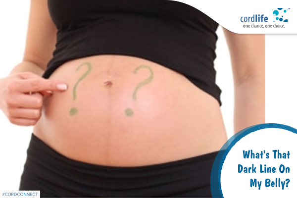 What's That Dark Line On My Belly? - Cordlife India