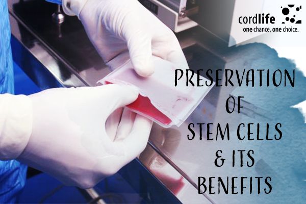 7 Benefits Of Preserving Stem Cells Cordlife India