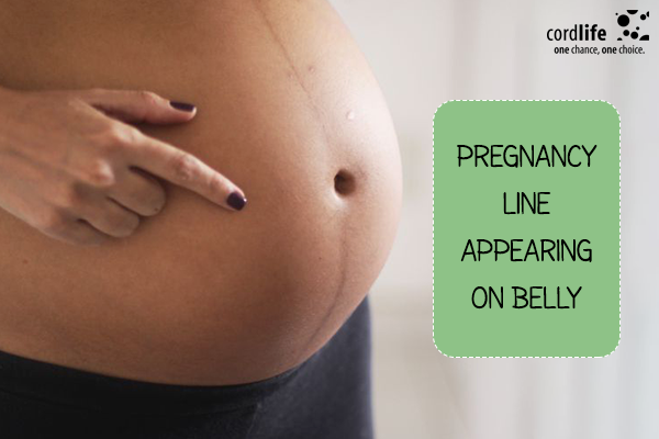 Pregnancy Line Appearing On Belly 
