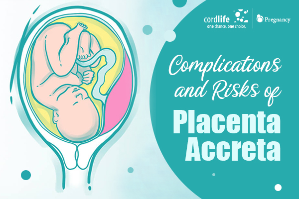 Complications And Risks Of Placenta Accreta Cordlife India