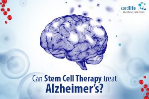 Can Stem Cell Therapy Treat Alzheimer’s? - Cordlife India