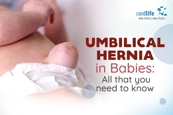 Umbilical Hernia In Babies: All That You Need To Know