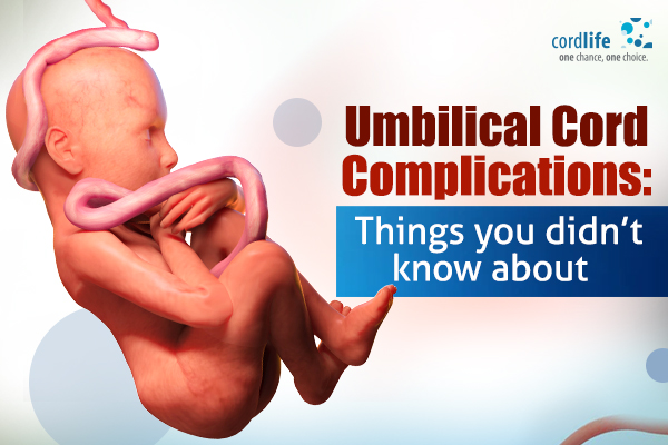 Umbilical Cord Complications: Things You Did Not Know About