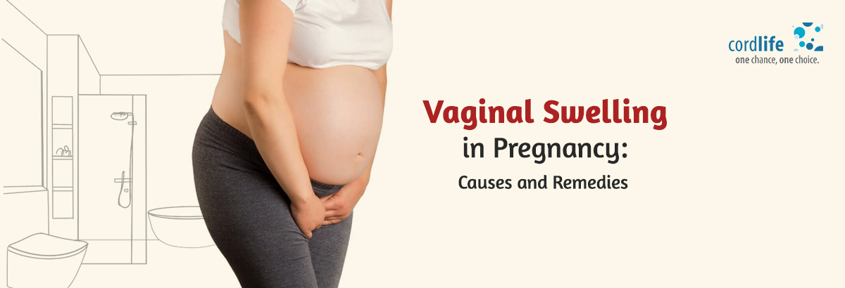 Vaginal Swelling in Pregnancy