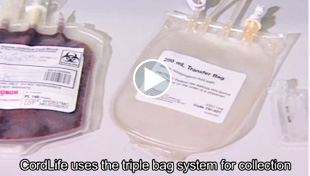 Cord blood collection process (real cord blood)