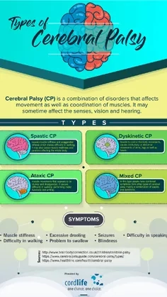 Types of Cerebral Palsy thumbnail